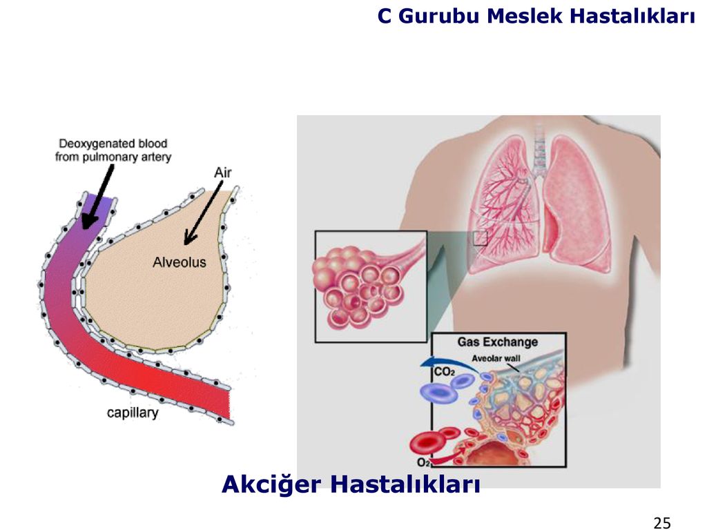 Yerlerinde Sa L K G Zetimi Ve Meslek Hastal Klar Ppt Indir